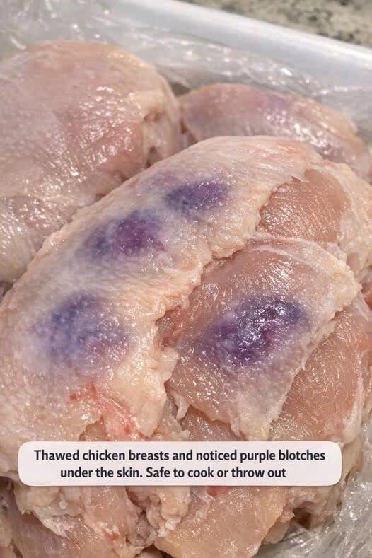 Thawed chicken breasts and noticed purple blotches under the skin. Safe to cook or throw out
