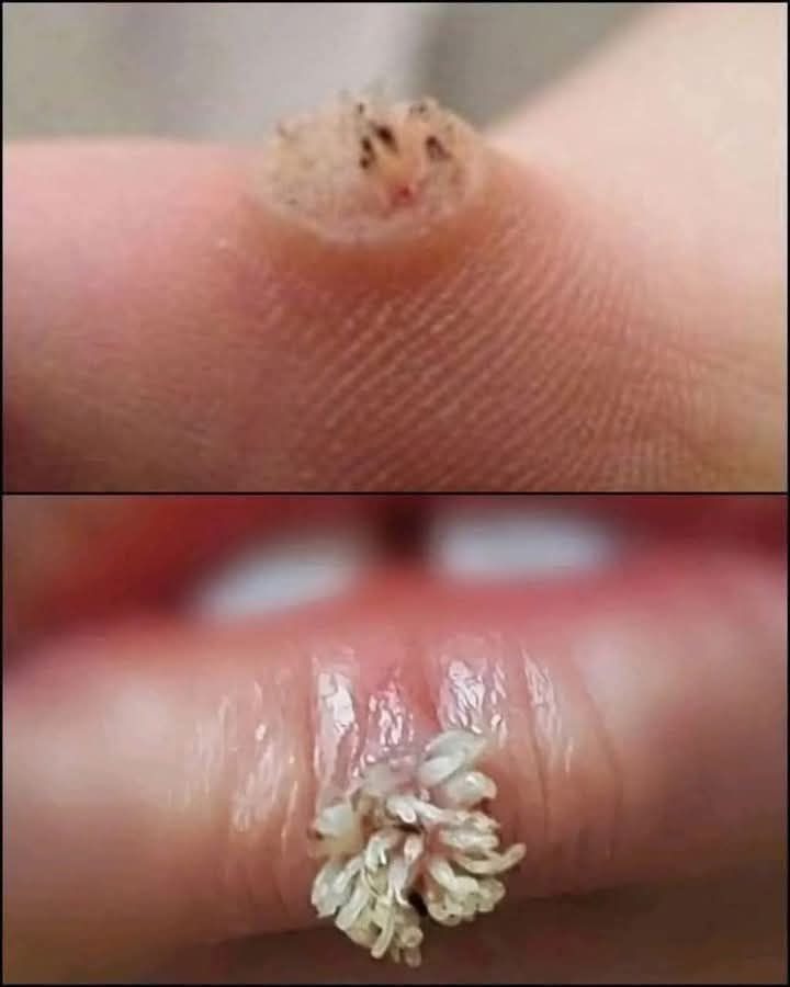 BE VERY CAREFUL . If you get this, you are infected with …. See more