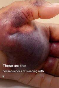This is what can happen when you sleep with a… See more…