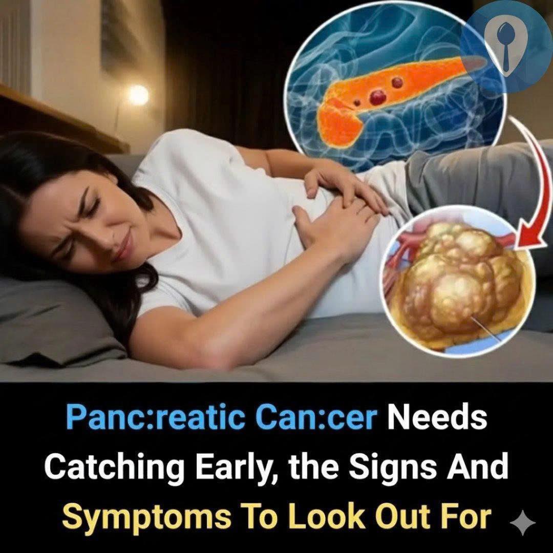 Pan.creatic can.cer: 10 early warning signs you should never ignore