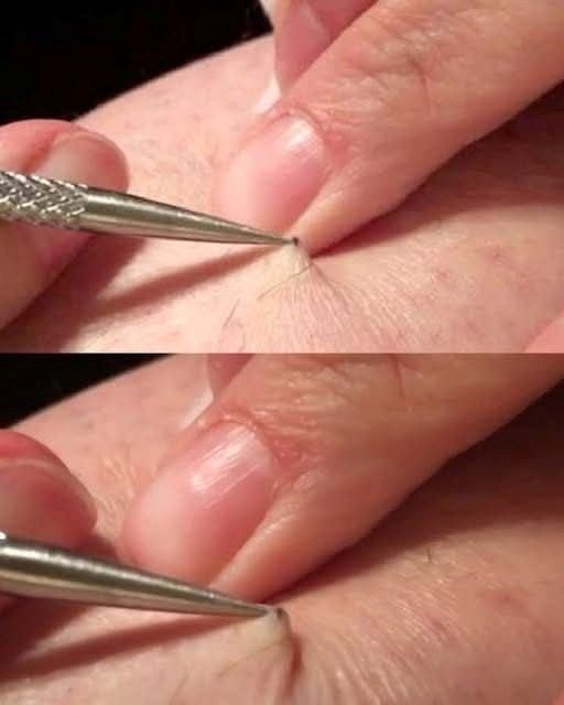 A Man Notices a Dark Spot on His Leg — What He Later Learned Surprised Many People