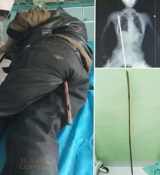 HT2. Young man hospitalized after being arrested…See more