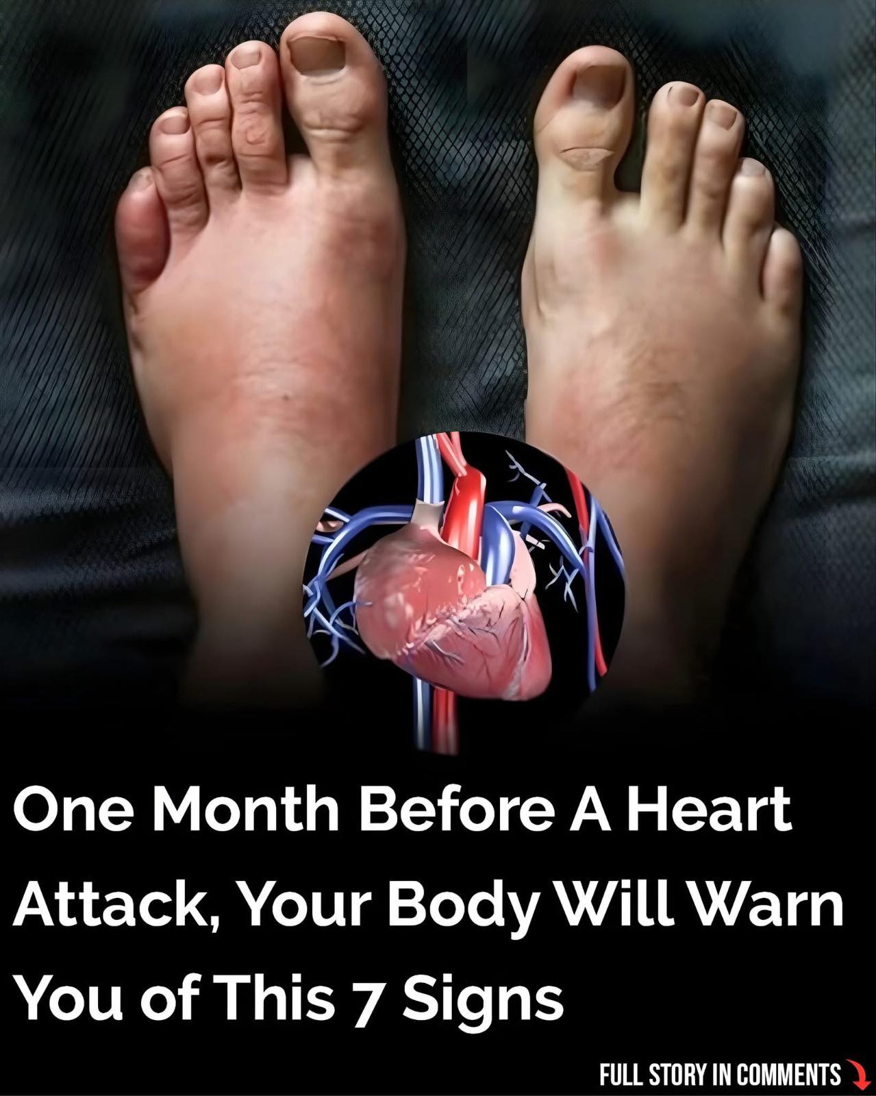 7 Warning Signs of a Heart Attack You Should Never Ignore (Early Symptoms Everyone Should Know)