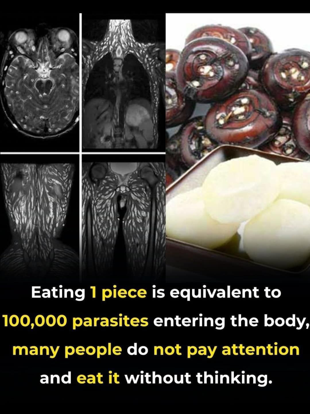 The Truth About “100,000 Parasites in One Bite”: A Food Safety Reality Check