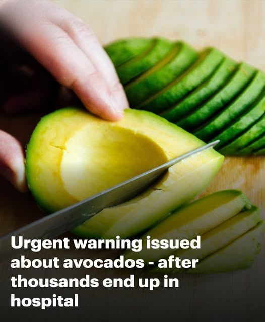 ER doctor’s urgent warning about avocados – after thousands end up in hospital with the same problem