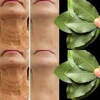 Bay Leaf: Nature’s Powerful Skin Secret?