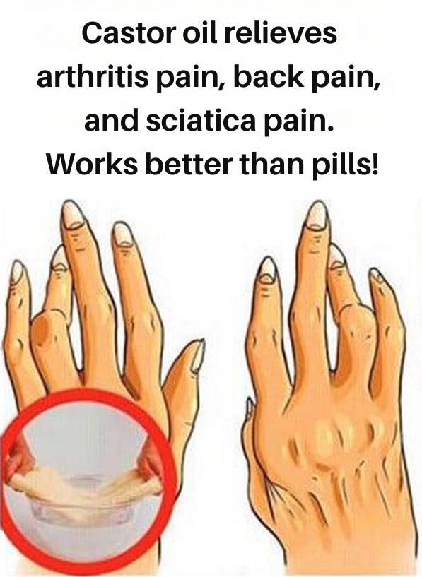 Castor Oil for Back Pain, Sciatica Pain and Arthritis