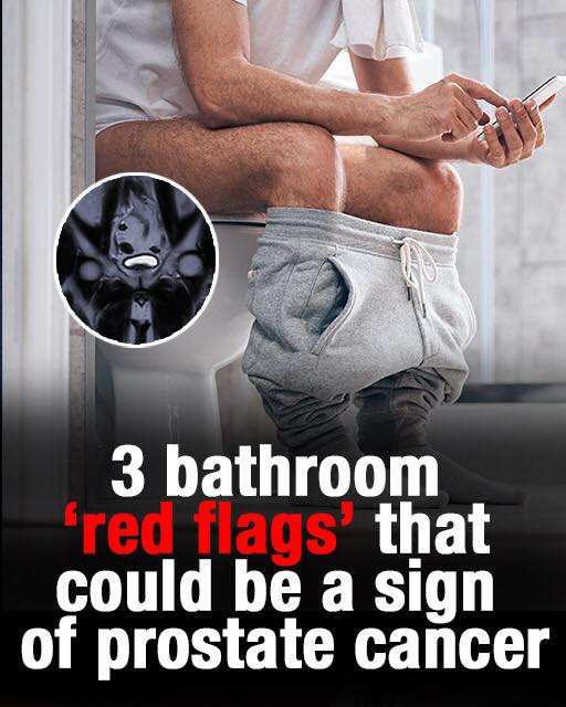 3 bathroom ‘red flags’ that could be a sign of prostate cancer