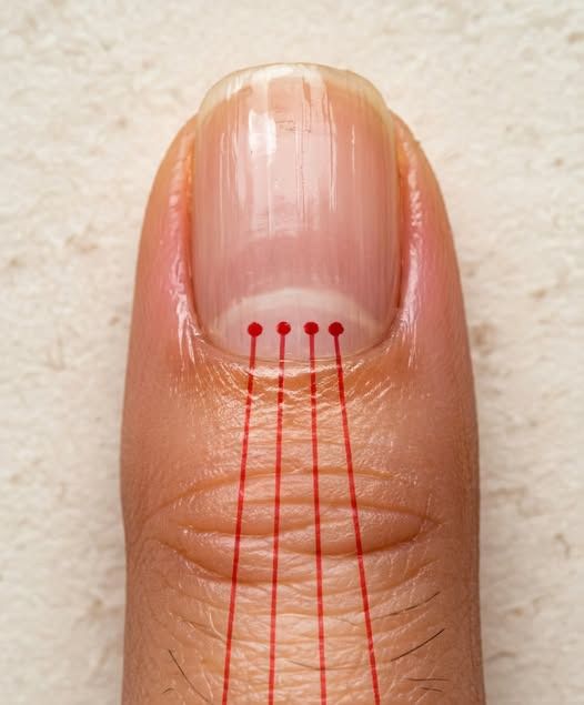 Easy Guide to Nail Lines After 40: What Your Nails May Reveal About Your Health