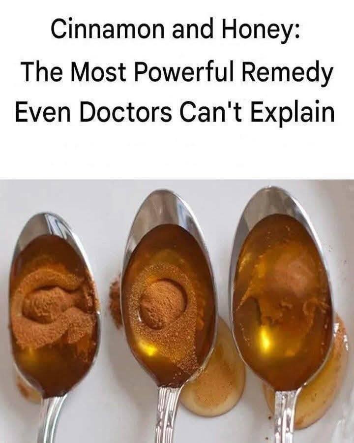 Cinnamon and Honey: The Most Powerful Natural Remedy Even Doctors Struggle to Explain
