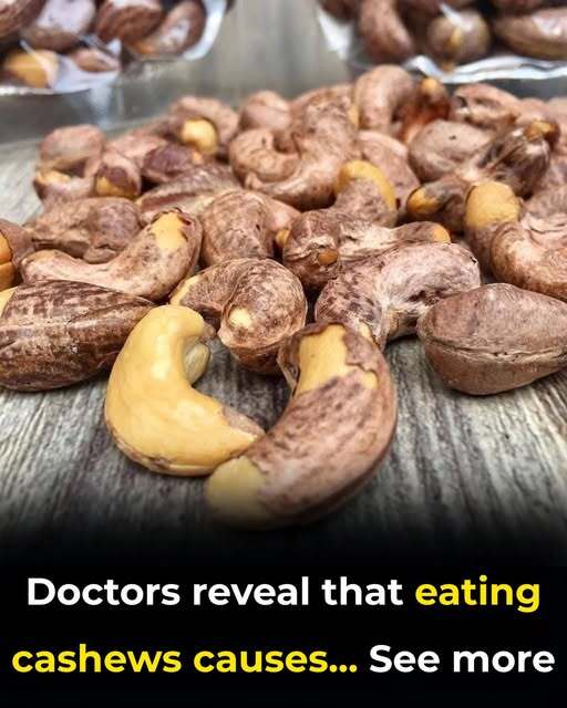 Doctors reveal that eating cashews causes Ashton
