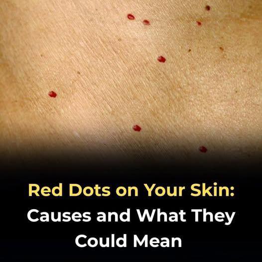 Red dots on your skin: Causess and what they could mean