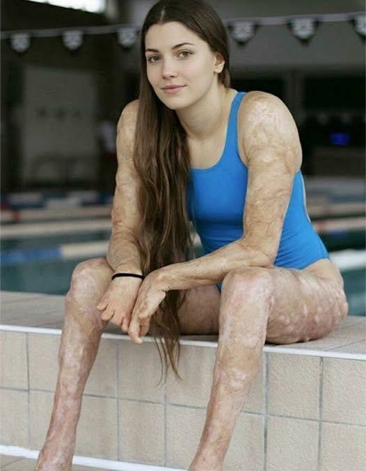 These are the consequences of sleeping with the…See more