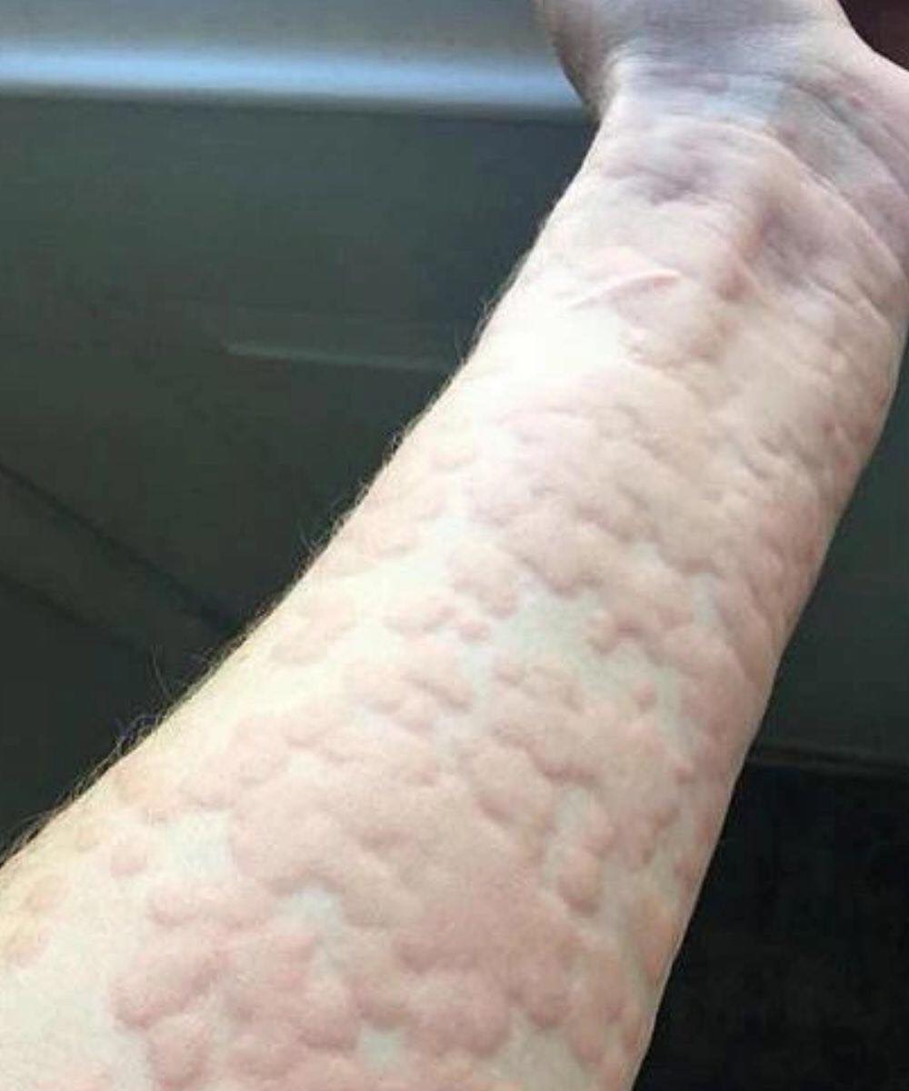These are the consequences of sleeping withs…