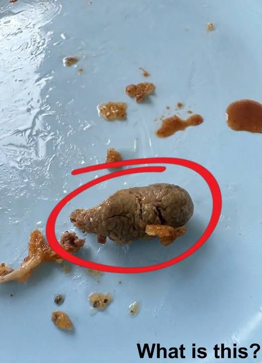Found this in my fried chicken. It was in the breαst.