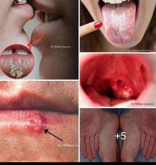 These are the sign that he is cr… See more