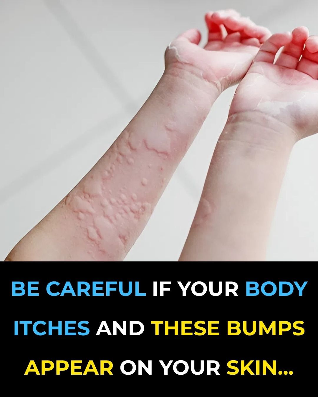 These are the consequences of sleepings with…