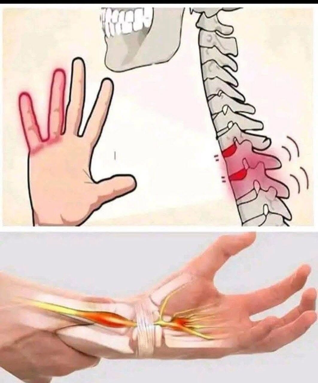 Hands Falling Asleep at Night? Paresthesia: Causes and Solutions