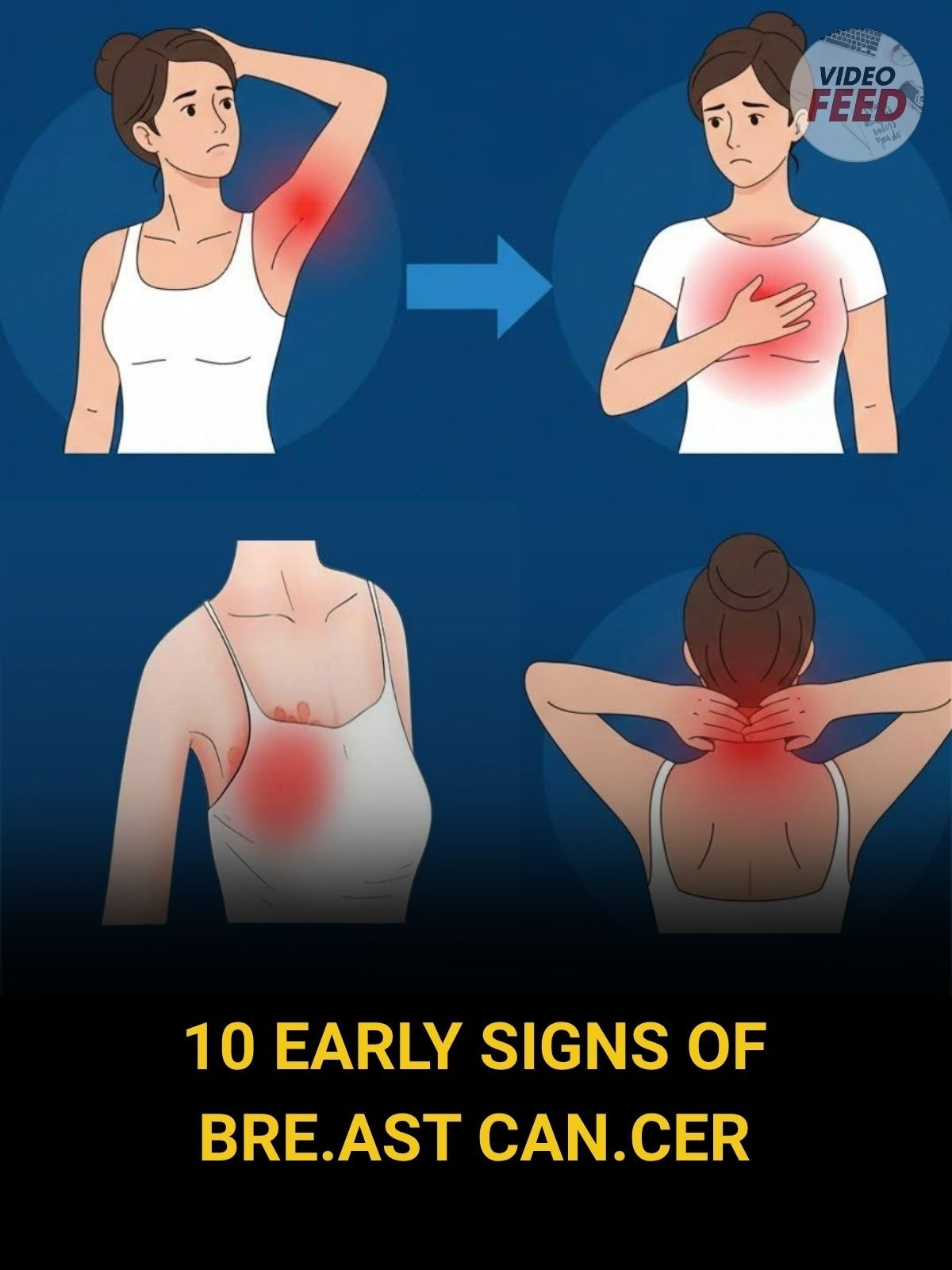 10 Warning Signs of Breast Cancer You Should Never Ignore