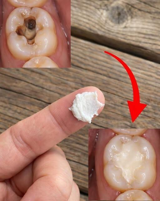 Your Kitchen Pharmacy: 5 Simple, Natural Habits for a Healthier Smile