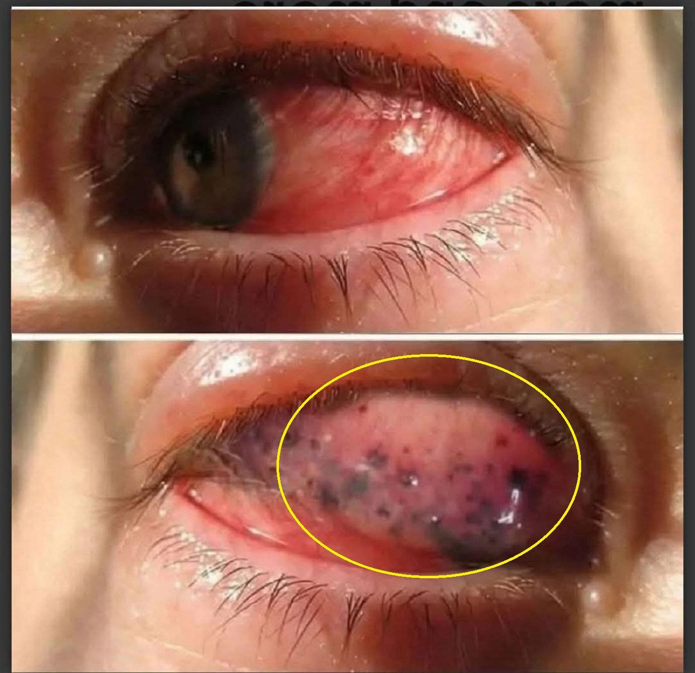 Theses are the consequences of sleeping with…𝗦𝗲𝗲 𝗺𝗼𝗿𝗲