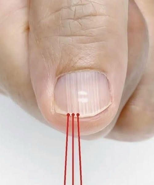Vertical Nail Ridges: Normal Changes and Nail Health