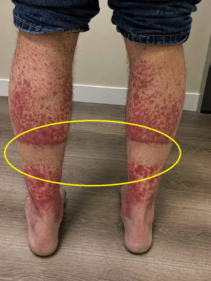 Warning Signs on Your Legs You Should Never Ignore: How a Safe Sleep Environment Protects Your Health