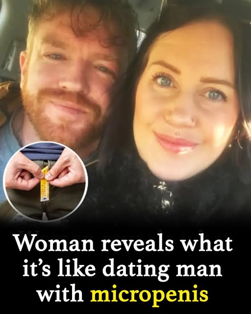 Woman opens up about love, laughs & life with her micro penis man