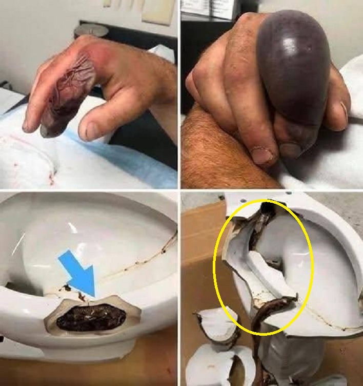 In several regions, while using their toilets, people were attacked by…𝗦𝗲𝗲 𝗺𝗼𝗿𝗲