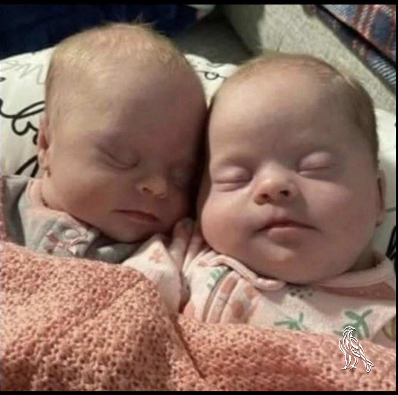 Mom of twins with Down syndrome shuts down critics