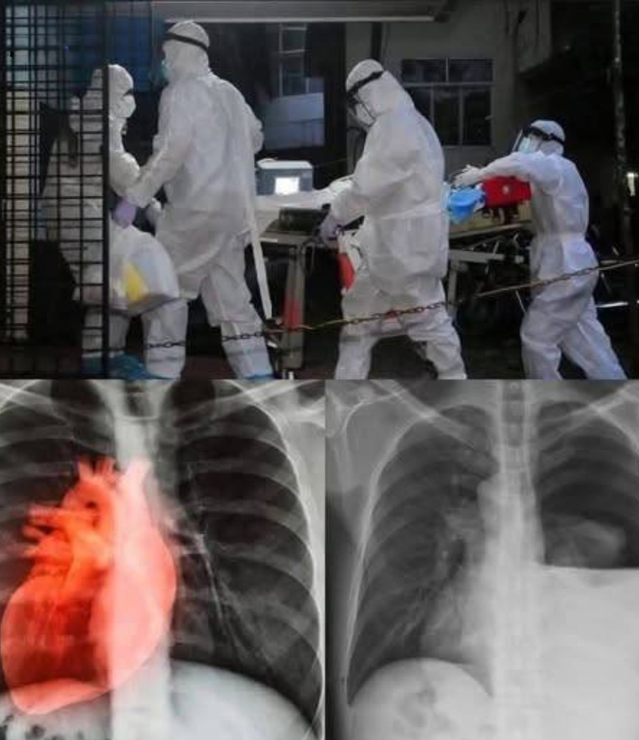 Understanding the Latest Updates on COVID-19 Vaccination Research