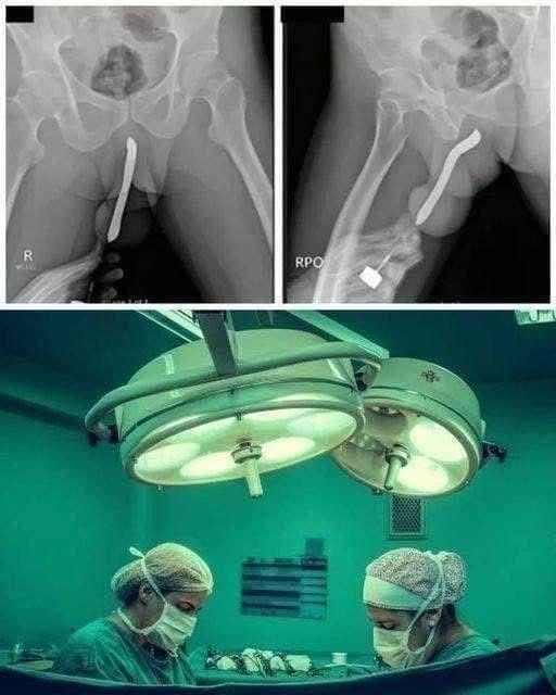 Girl had to be hospitalized for wanting to use a pe...See more