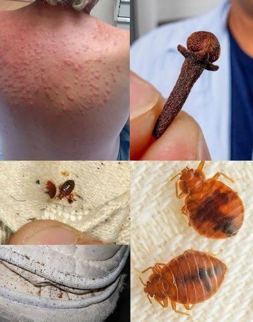 Bed Bug Prevention – A Safe Solution for Sleep and Family Health