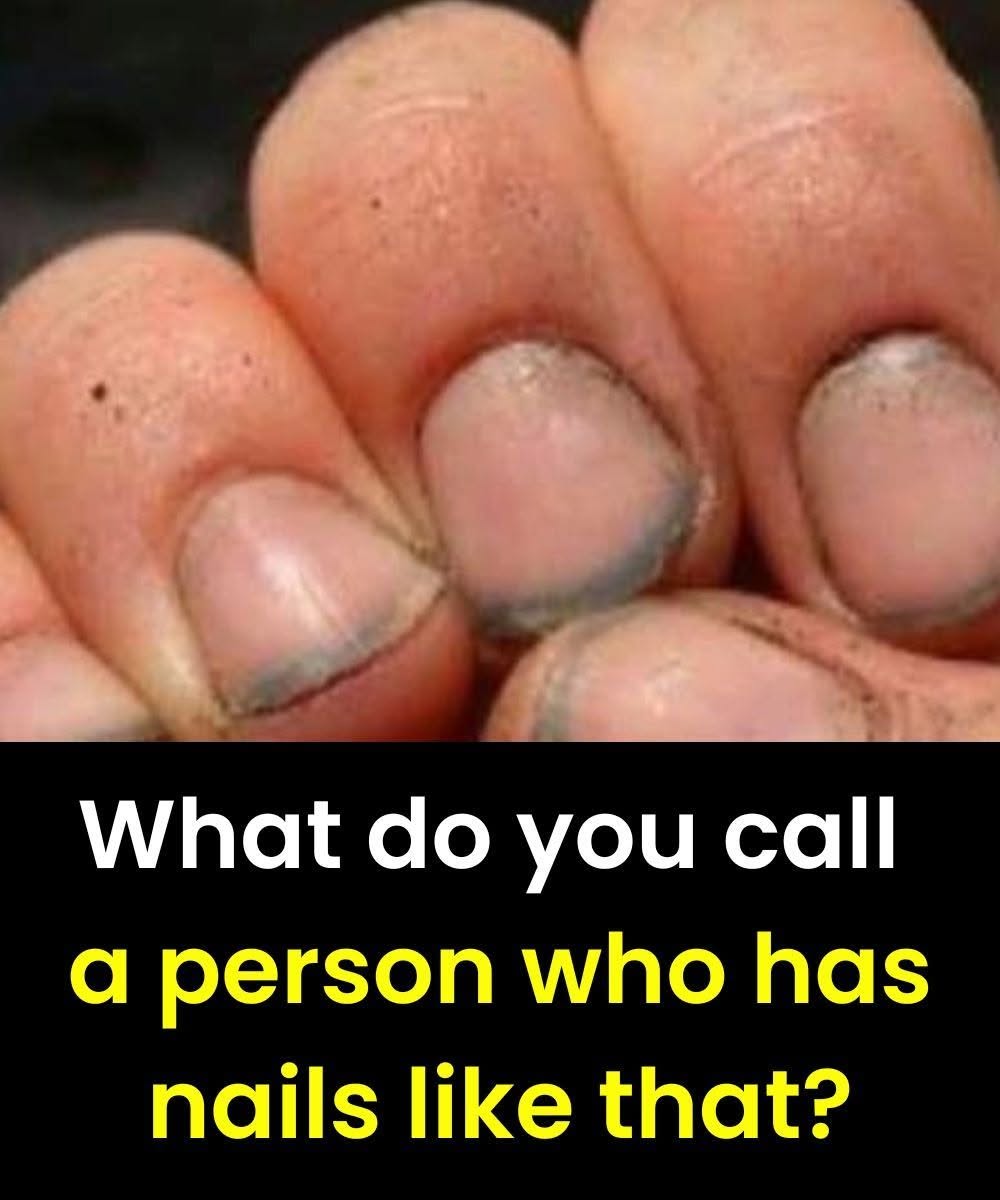 What do you call a person with nails like that?