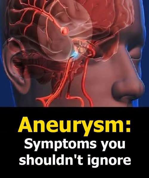 Aneurysm: Doctors misdiagnosed my ruptured brain aneurysm at 37 — the key wa.rning sign they overlooked