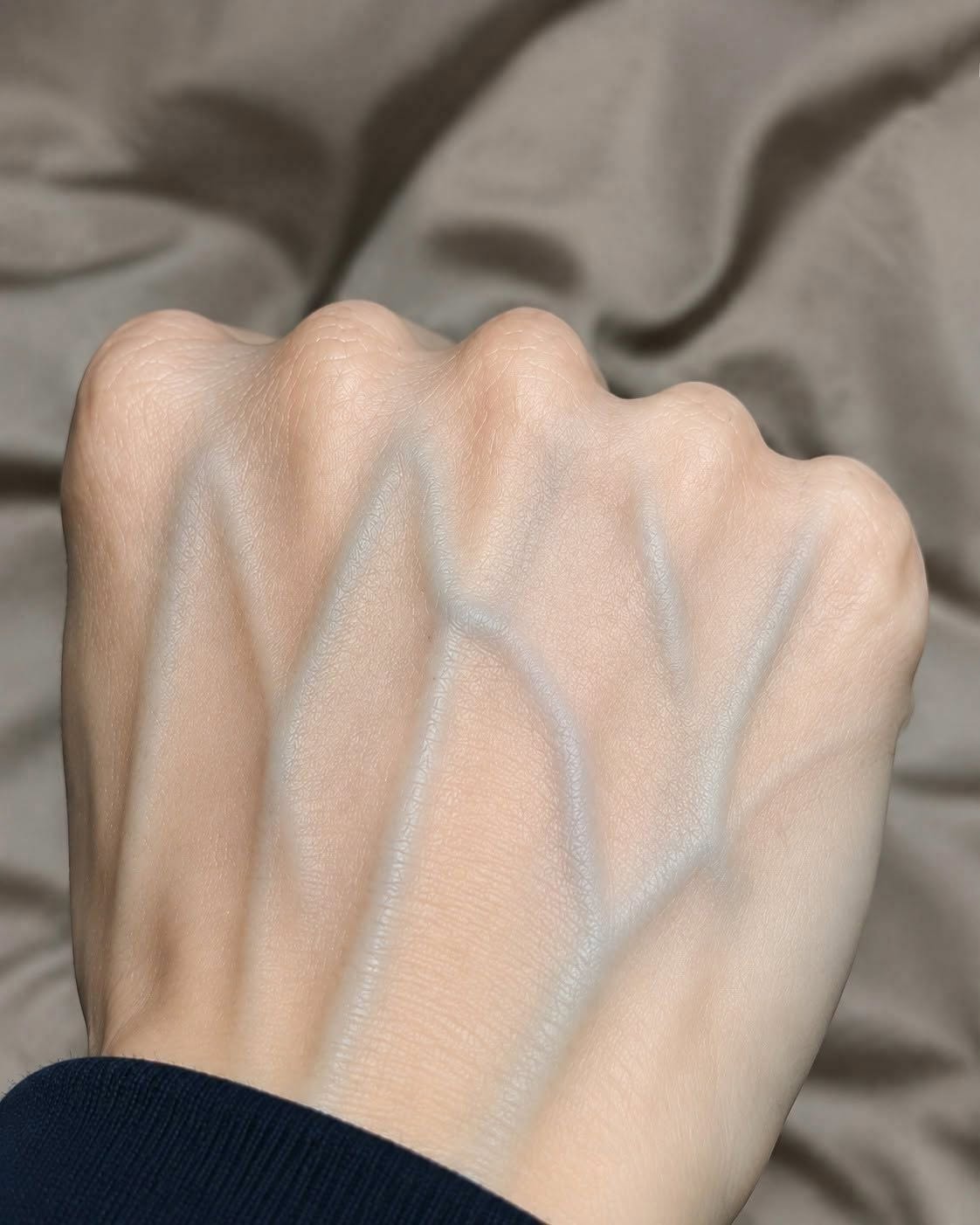 What the Veins on Your Hands Might Reveal About Your Kidney Health: Separating Myth from Medical Reality