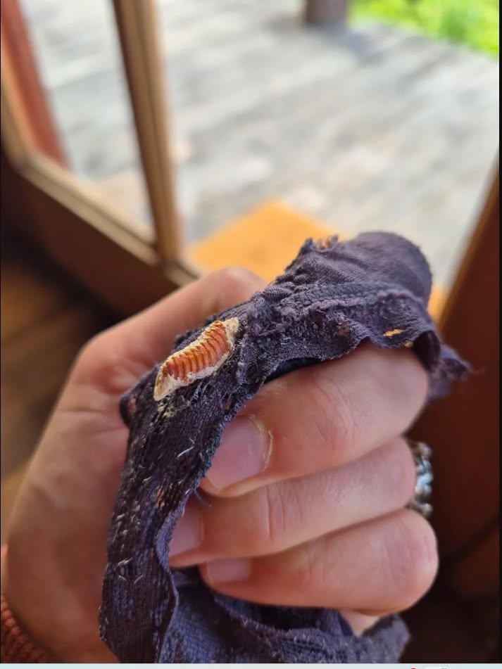 The “Stitch” in the Fabric: Why Finding This Hard Case on Your Clothes is a Travel Miracle