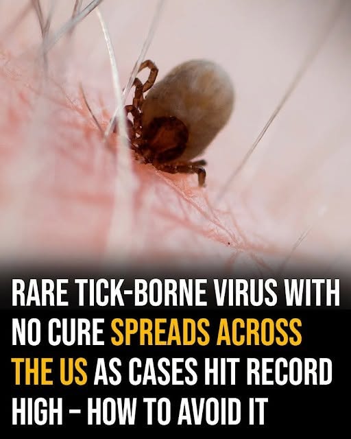 Rare tick-borne virus with no cure spreads across the US as cases hit record high – how to avoid it