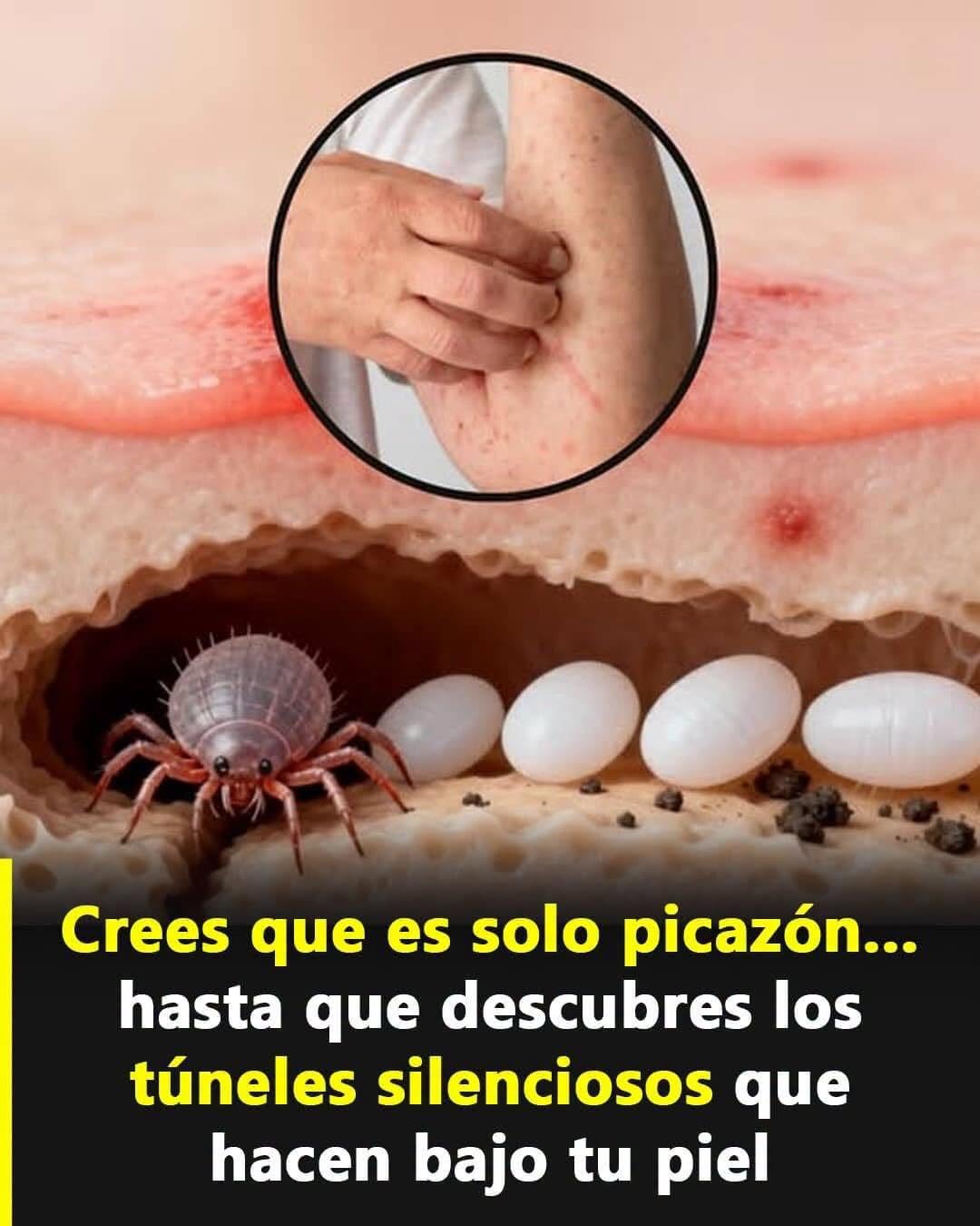 Alergia o sarna: claves para identificar sus diferencias y actuar a tiempo