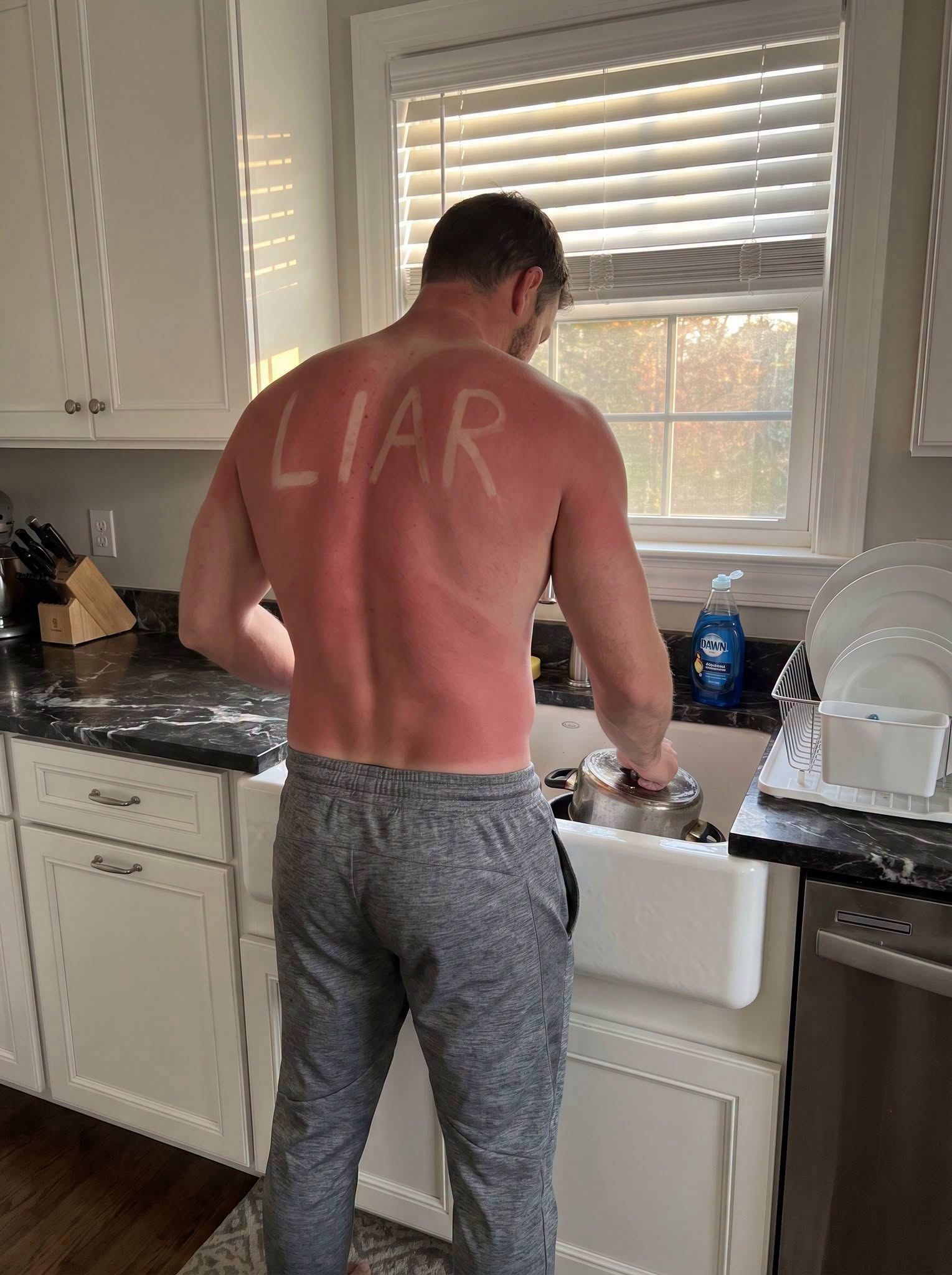 My Husband Returned From His ‘Business Trip’ With ‘CHEATER!’ Sunburned Across His Back. My Revenge Was Legendary!