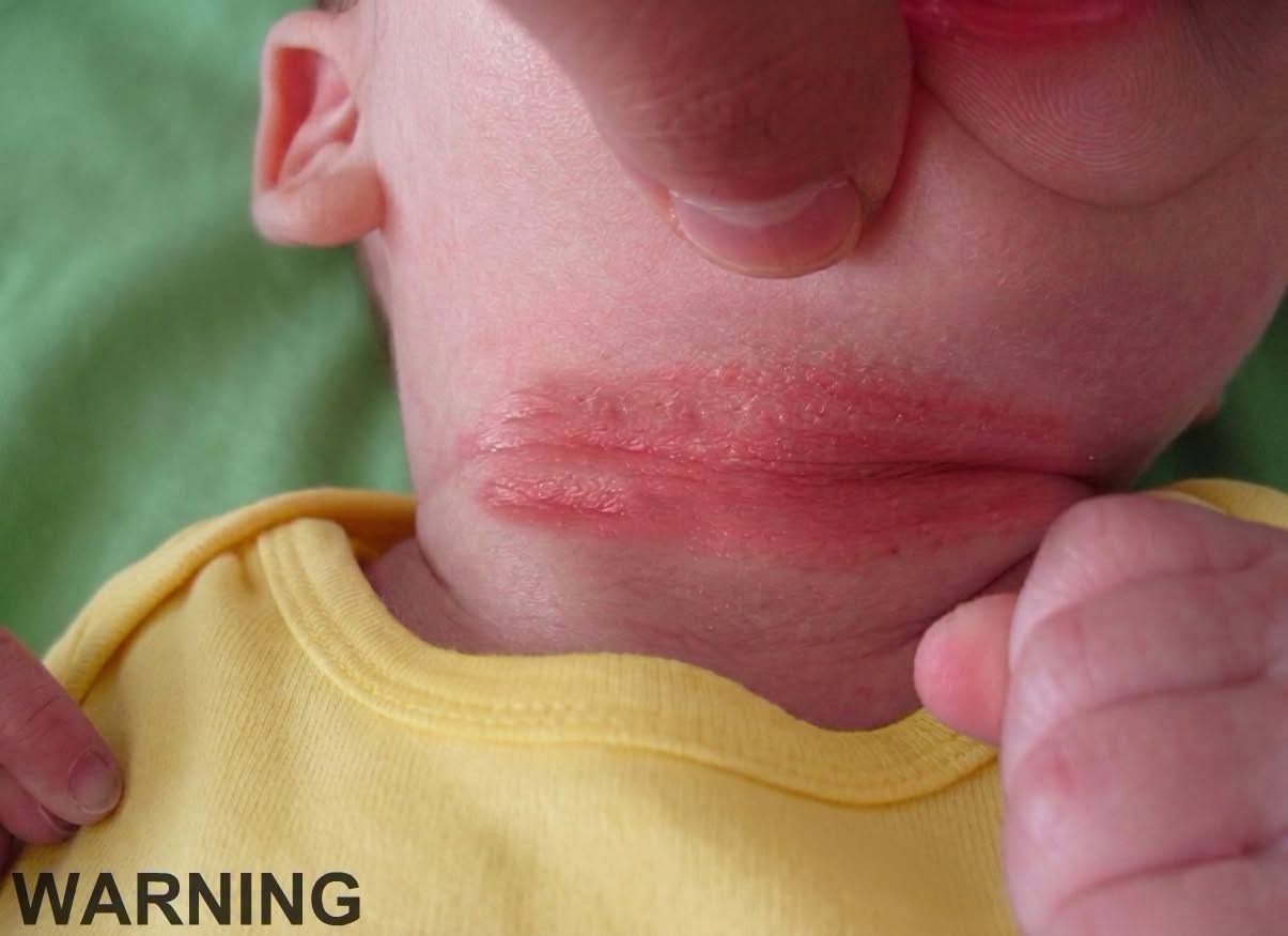 These are the signs that hes is crs… See more