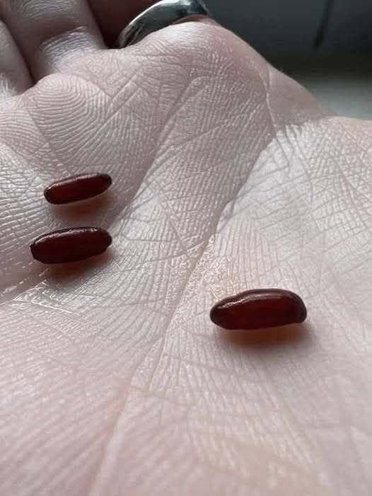 A Family’s Warning After a Sudden, Devastating Tick-Borne Illnesss