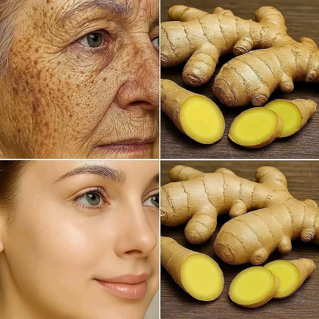 Discover the Power of Ginger for Glowing Skin