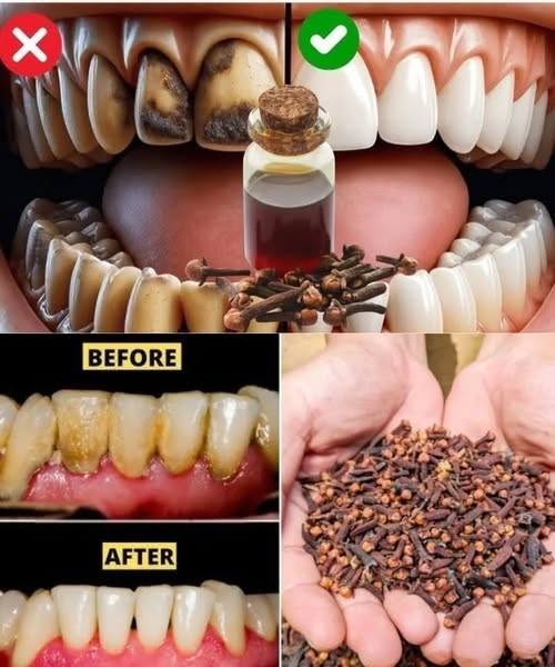 A title like “9 Natural Ways to Remove Plaque & Tartar Buildup” needs an important clarification: