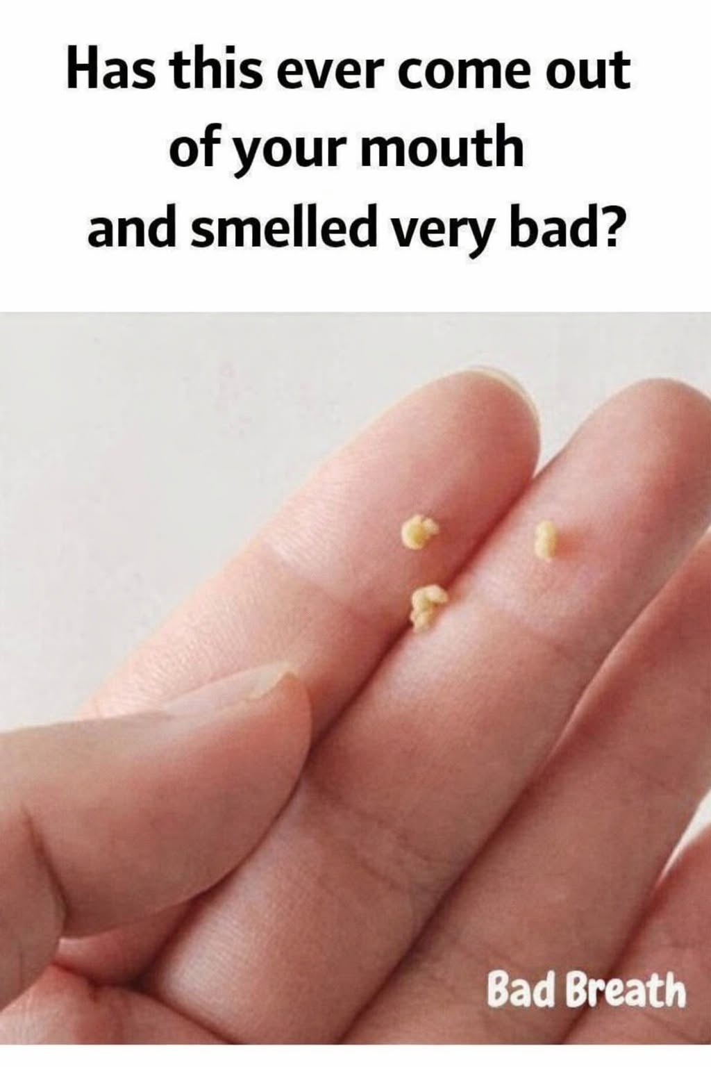 My mouth smells really bad: causes and solutions for bad breath