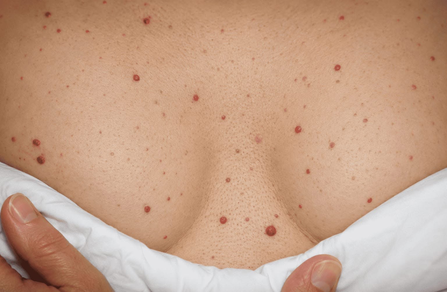 The Truth Behind Those Mysterious Red Spots on Your Skin