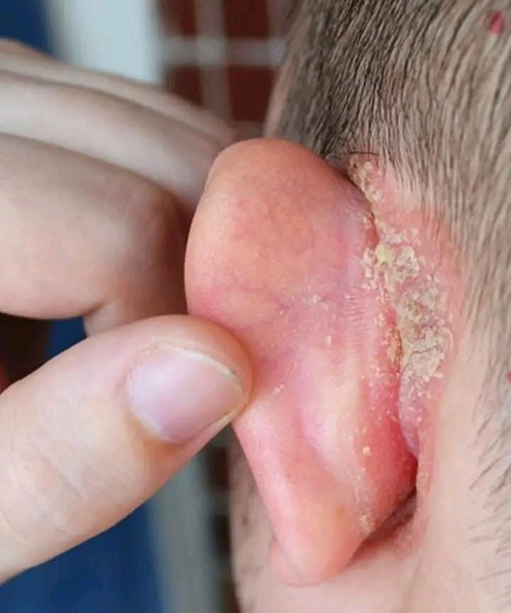 My son woke up with a spot on his ear: what could it be and how can I treat it until the appointment?