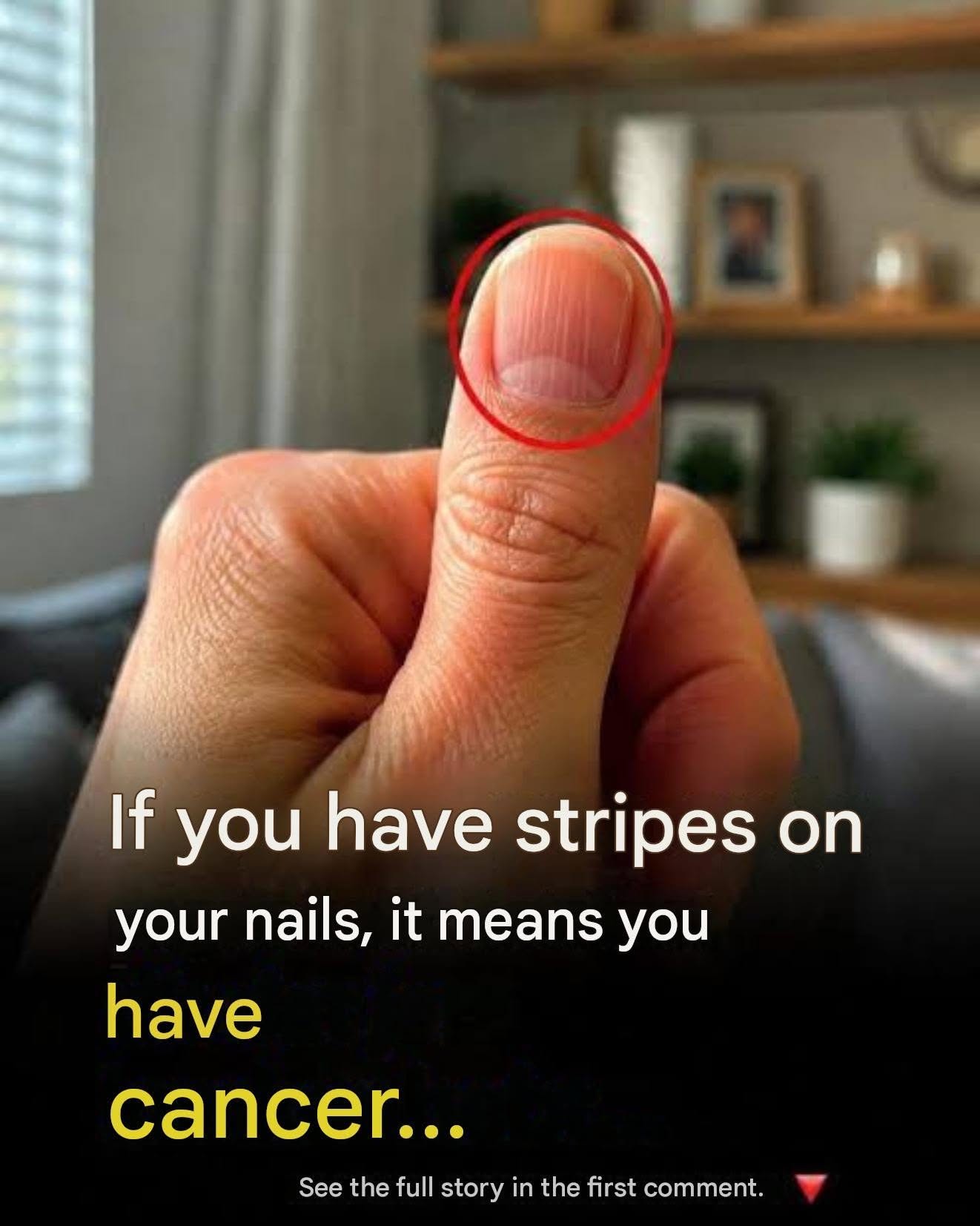 Lines on your fingernails: what they might reveal about your health