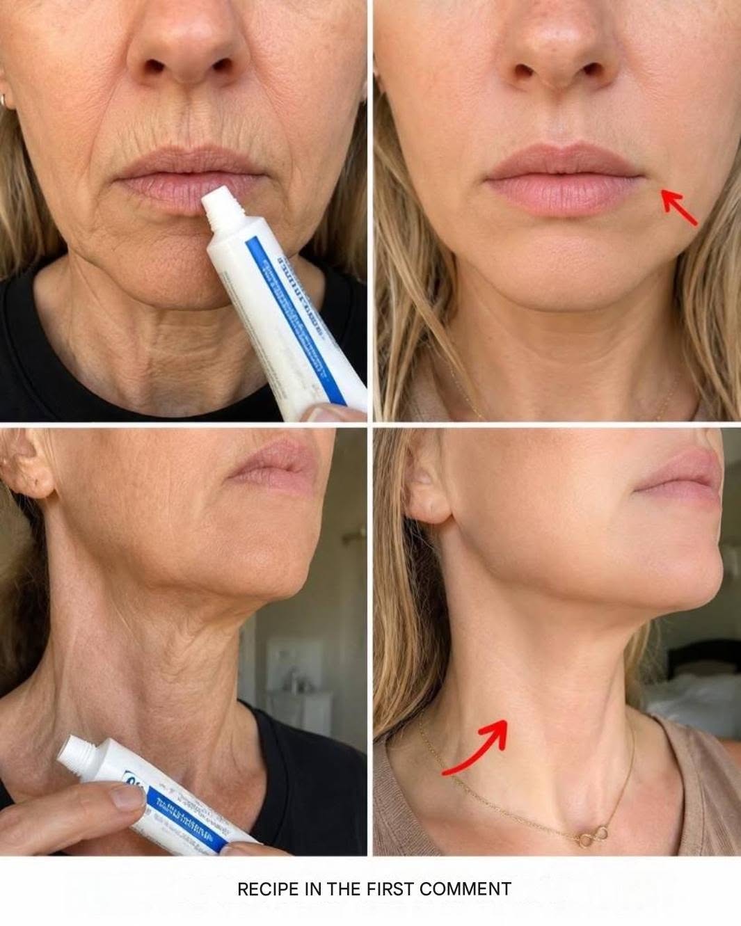 “I look like I’ve had surgery”: The home remedy for wrinkles and age spots on hands and arms.
