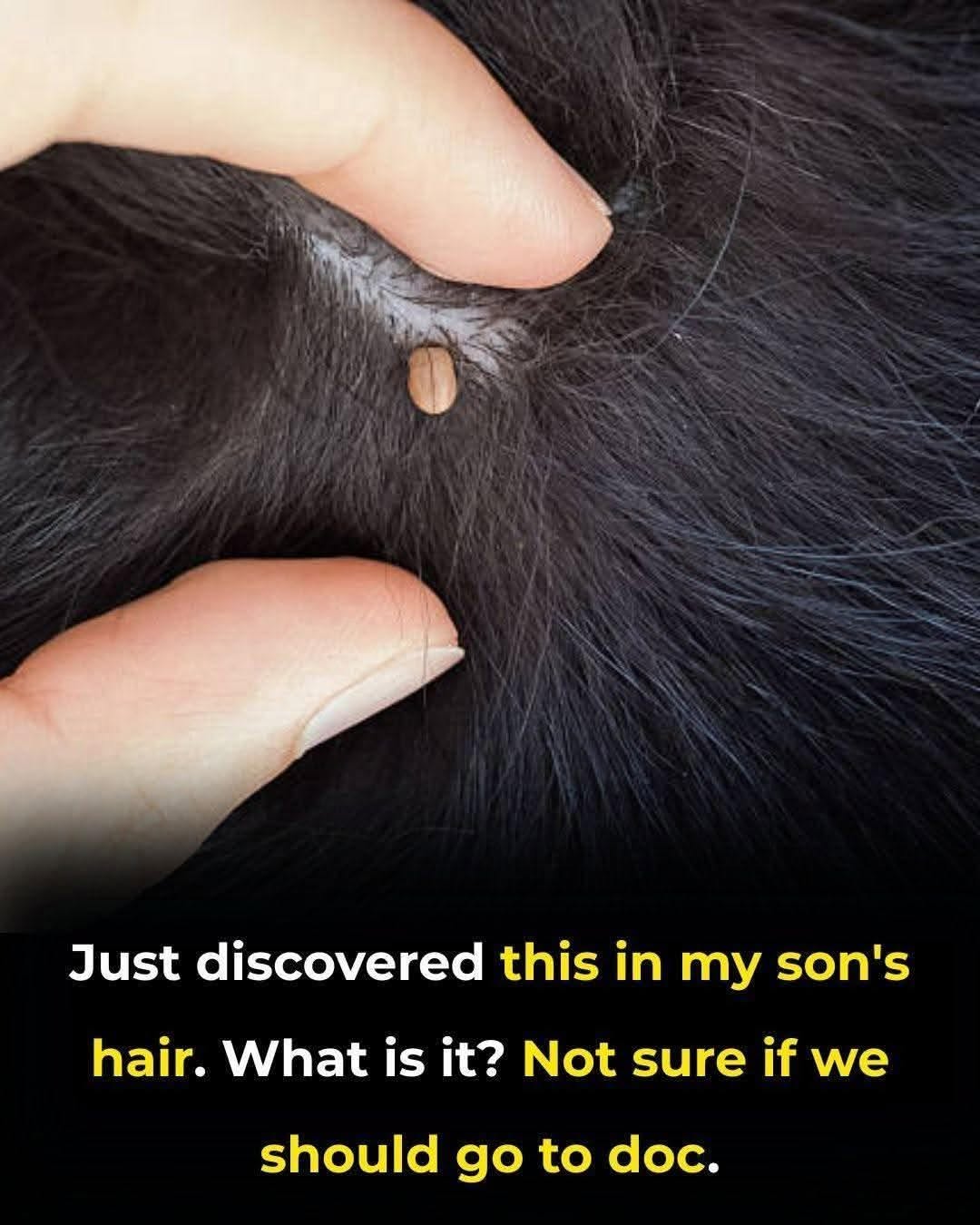 Just discovered this in my son’s hair. What is it? Not sure if we should go to doc